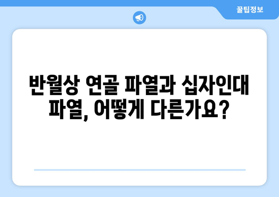 반월상 연골 파열 vs 십자인대 파열| 어떤 치료가 필요할까요? | 무릎 부상, 치료 방법, 재활