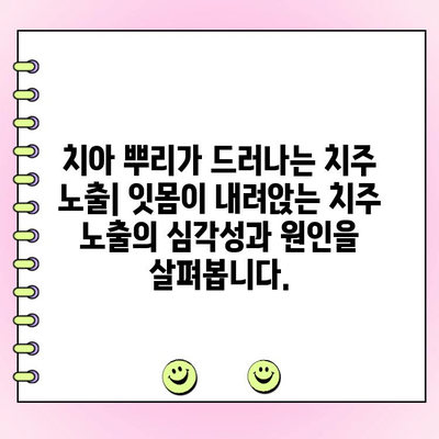 치주 골 손실과 치주 노출| 깊어지는 연관성 | 치주 질환, 치아 건강, 치과 치료